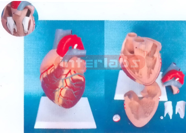 MIDDLE HEART WITH PULMONARY ARTERY STENOSIS